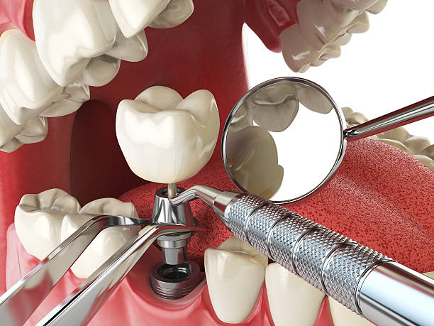 Best After-Hours Emergency Dentist in Lakesite, TN